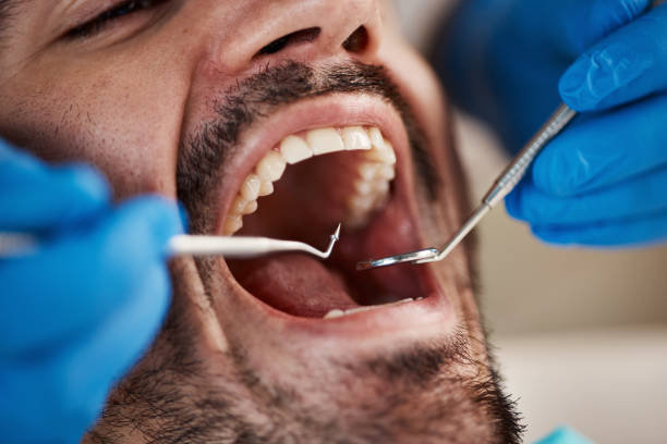 Best Emergency Dentist for Lost Fillings or Crowns in Magalia, CA